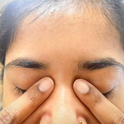 Close-your-eyes-gently-dont-blink-and-press-the-corner-of-your-eye-near-your-nose-for-2–3-minutes